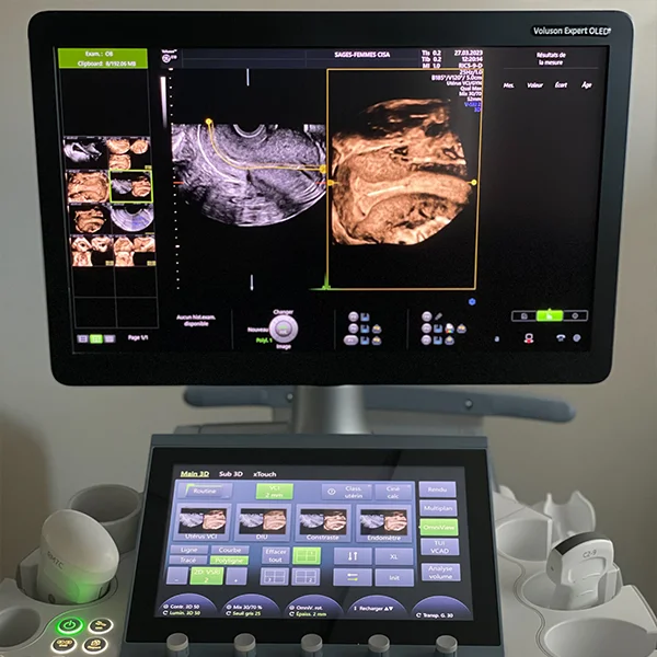 Échographie pelvienne au pôle médical du bouscat